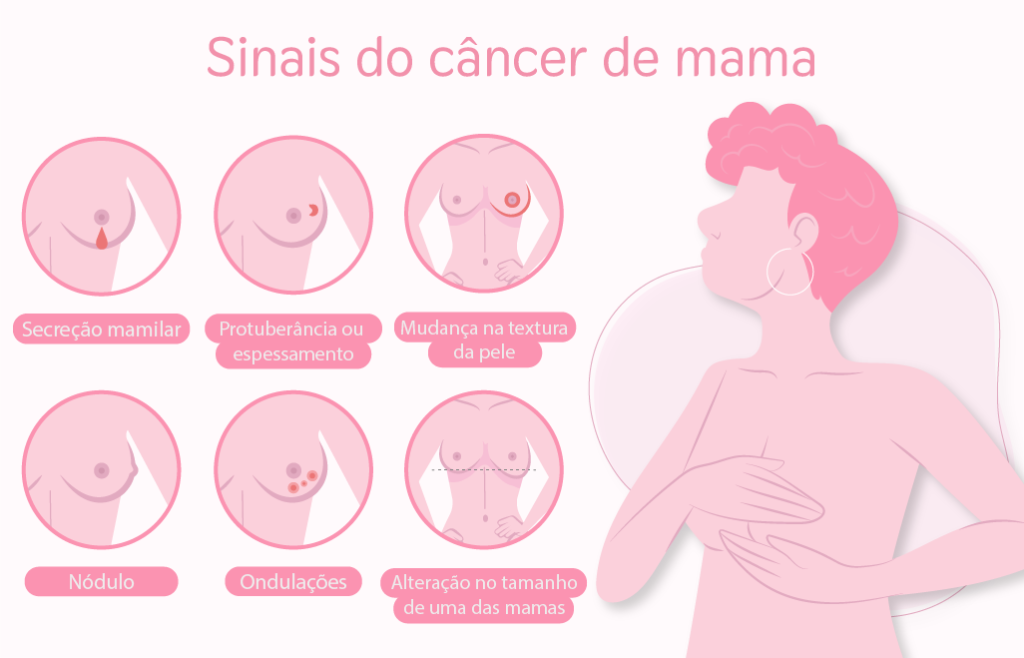 rastreamento de câncer de mama 